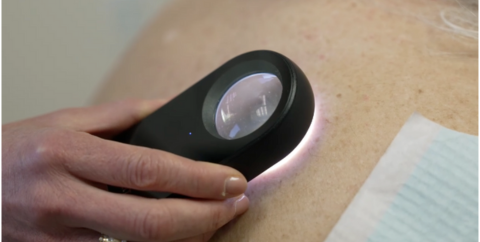 a dermatologist uses a dermatoscope to look for skin lesions